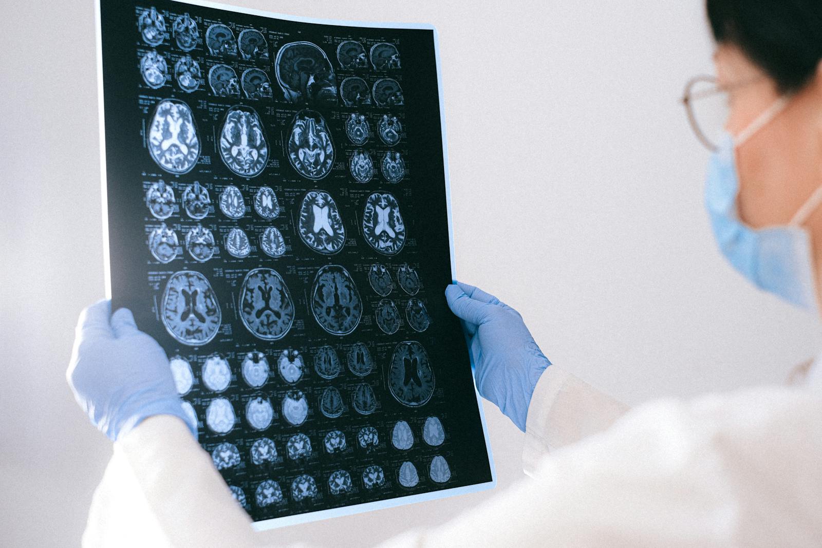 A medical professional reviewing MRI brain scans in a clinical setting, highlighting healthcare technology.